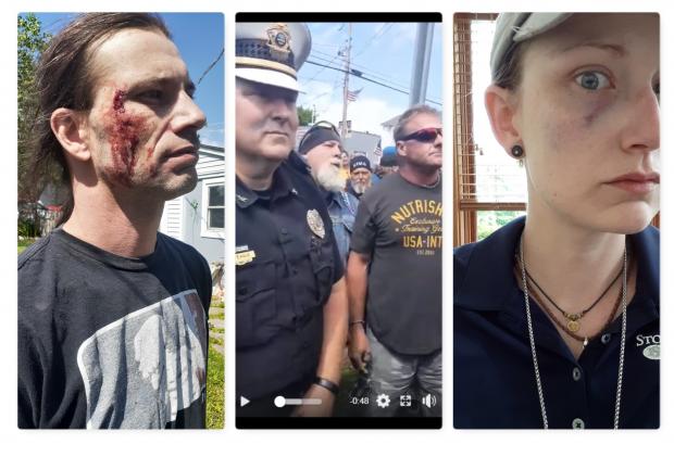 A guy with a bleeding face, cops and protestors