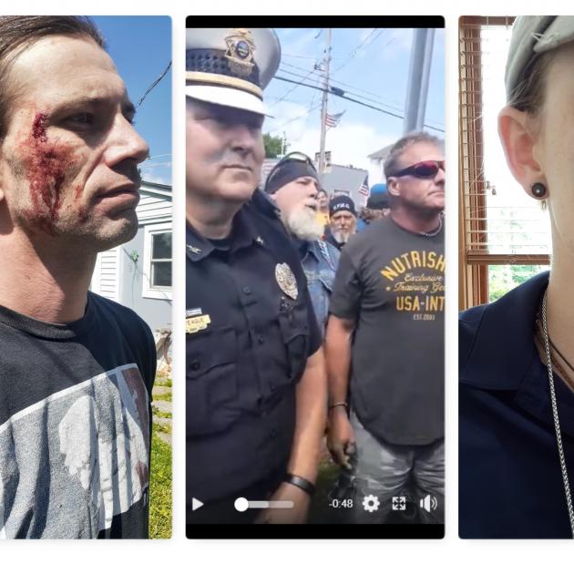 A guy with a bleeding face, cops and protestors