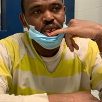 Man showing a spot in mouth where there is a gap.